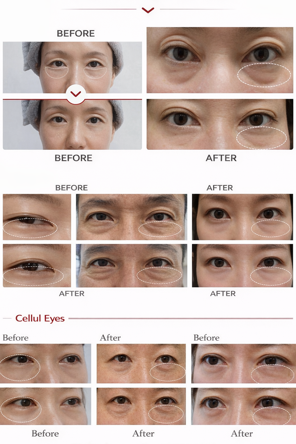 Cellul Eyes results after 9 days of use (before and after)